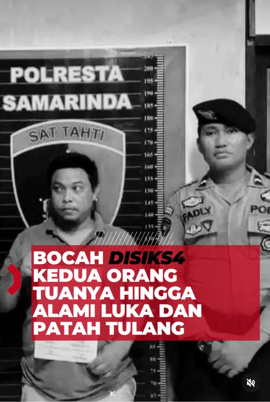 Kisah Tragis Bocah Kaki Patah dan Tubuh Penuh Luka Melepuh Diduga Dianiaya Orangtuanya