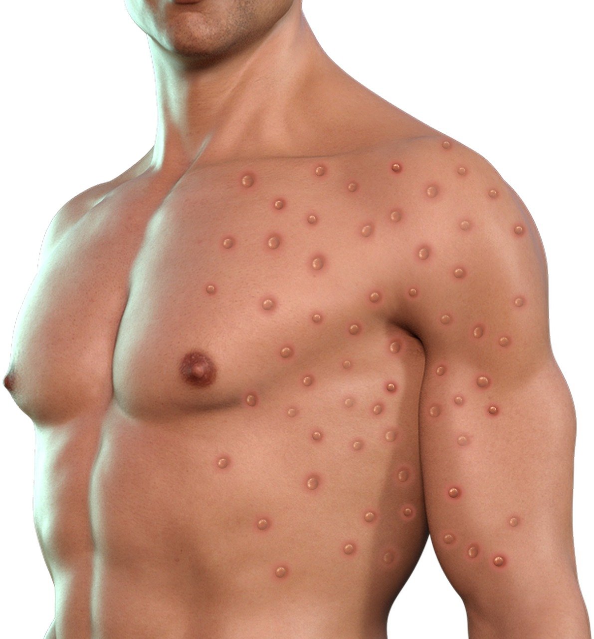 Kemenkes melaporkan total 88 kasus cacar monyet (Mpox) di Indonesia hingga Sabtu, 17 Agustus 2024. (Foto:pixabay)